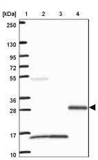 Lane 1: Marker [kDa] 250, 130, 95, 72, 55, 36, 28, 17, 10_br/_Lane 2: Human cell line RT-4_br/_Lane 3: Human cell line U-251MG sp_br/_Lane 4: Human plasma (IgG/HSA depleted)