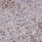 Immunohistochemical staining of human spleen shows high expression.