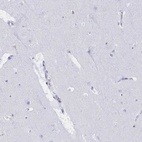 Immunohistochemical staining of human cerebral cortex shows low expression as expected.