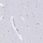 Immunohistochemical staining of human cerebral cortex shows low expression as expected.