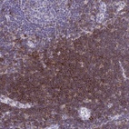 Anti-SPN Antibody