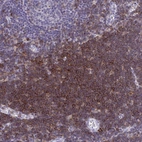 Immunohistochemical staining of human lymph node shows high expression.