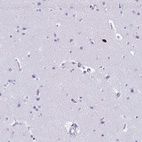 Immunohistochemical staining of human cerebral cortex shows low expression as expected.