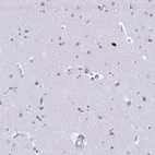 Immunohistochemical staining of human cerebral cortex shows low expression as expected.