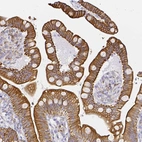 Immunohistochemical staining of human colon shows strong cytoplasmic-membranous positivity in glandular cells.