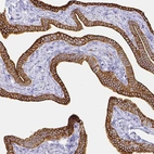 Immunohistochemical staining of human fallopian tube shows strong membranous positivity in glandular cells.