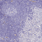 Anti-SMURF1 Antibody