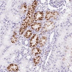 Anti-TMEM200B Antibody