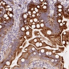 Anti-YIF1B Antibody