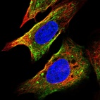 Immunofluorescent staining of human cell line U-2 OS shows localization to cytosol & vesicles.