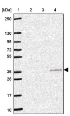 Lane 1: Marker [kDa] 250, 130, 95, 72, 55, 36, 28, 17, 10_br/_Lane 2: Human cell line RT-4_br/_Lane 3: Human cell line U-251MG sp_br/_Lane 4: Human plasma (IgG/HSA depleted)