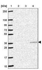 Lane 1: Marker [kDa] 250, 130, 95, 72, 55, 36, 28, 17, 10_br/_Lane 2: Human cell line RT-4_br/_Lane 3: Human cell line U-251MG sp_br/_Lane 4: Human plasma (IgG/HSA depleted)