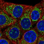 Immunofluorescent staining of human cell line MCF7 shows localization to nucleoli & mitochondria.