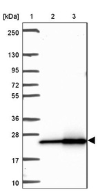 Lane 1: Marker [kDa] 250, 130, 95, 72, 55, 36, 28, 17, 10_br/_Lane 2: Human cell line RT-4_br/_Lane 3: Human cell line U-251MG sp
