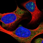Immunofluorescent staining of human cell line U-2 OS shows localization to nucleoli, cytosol & endoplasmic reticulum.