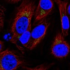 Anti-SPCS1 Antibody