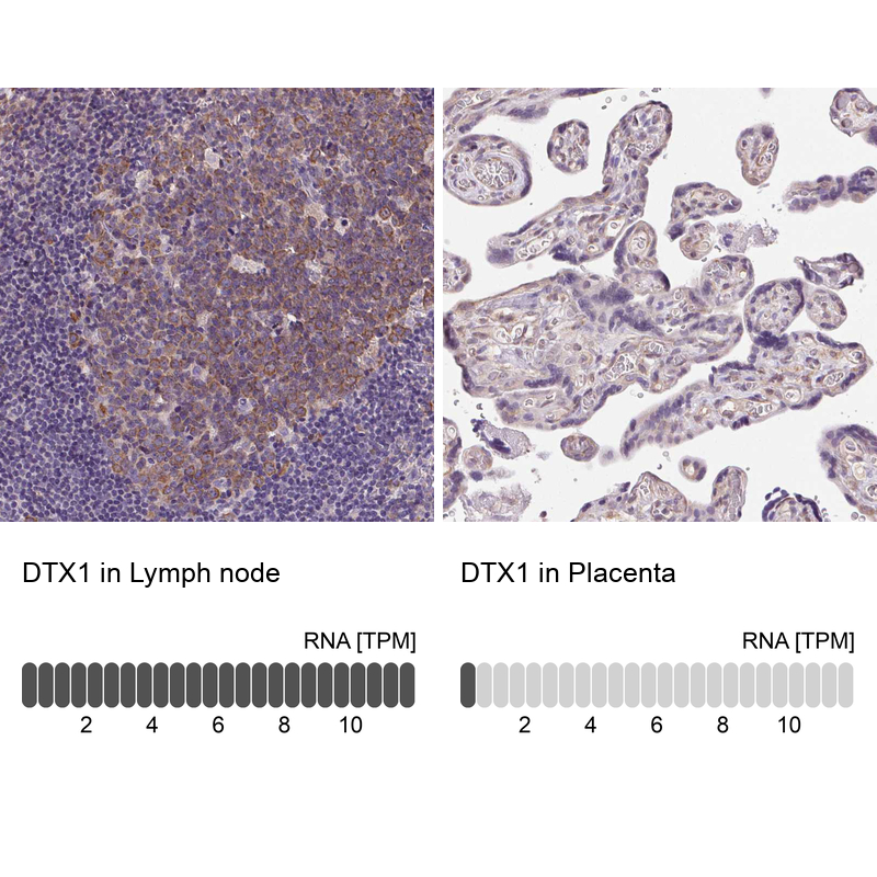 Anti-DTX1 Antibody