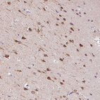 Immunohistochemical staining of human Cerebral cortex shows moderate nuclear and cytoplasmic positivity in neuronal cells.