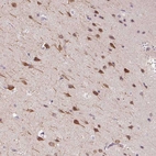 Immunohistochemical staining of human Cerebral cortex shows moderate nuclear and cytoplasmic positivity in neuronal cells.