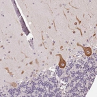 Immunohistochemical staining of human Cerebellum shows moderate cytoplasmic positivity in Purkinje cells.