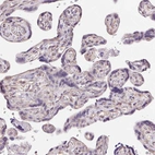 Immunohistochemical staining of human Placenta shows no positivity in trophoblastic cells as expected.