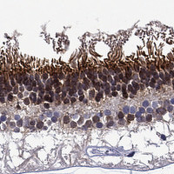 Anti-SPTBN5 Antibody