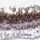 Anti-SPTBN5 Antibody