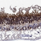 Anti-SPTBN5 Antibody