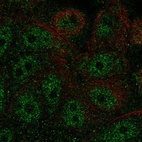 Anti-FBP2 Antibody