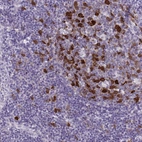 Immunohistochemical staining of human tonsil shows moderate to strong cytoplasmic positivity in germinal center cells.