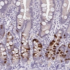 Immunohistochemical staining of human small intestine shows moderate to strong cytoplasmic positivity in enteroendocrine cells.