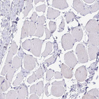 Immunohistochemical staining of human skeletal muscle shows no positivity in myocytes as expected.