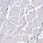 Immunohistochemical staining of human skeletal muscle shows no positivity in myocytes as expected.