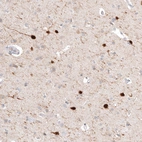 Immunohistochemical staining of human cerebral cortex shows strong cytoplasmic positivity in a subset of neurons.