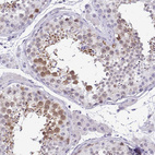Immunohistochemical staining of human testis shows moderate cytoplasmic positivity in cells in seminiferous ducts.