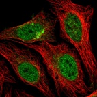 Immunofluorescent staining of human cell line HeLa shows localization to nucleoplasm & the Golgi apparatus.