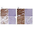 Anti-CASQ2 Antibody