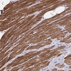 Immunohistochemical staining of human heart muscle shows strong cytoplasmic positivity in cardiomyocytes.
