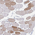 Anti-CASQ2 Antibody