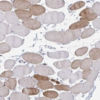 Immunohistochemical staining of human skeletal muscle shows weak cytoplasmic positivity in subset of myocytes.