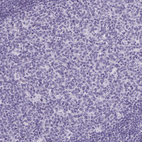 Anti-CASQ2 Antibody