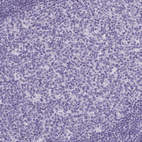 Immunohistochemical staining of human lymph node shows no positivity in germinal center cells as expected.