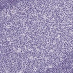 Immunohistochemical staining of human lymph node shows no positivity in germinal center cells as expected.