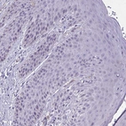 Immunohistochemical staining of human skin shows no positivity in squamous epithelial cells as expected.