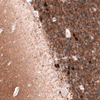 Immunohistochemical staining of human cerebellum shows moderate to strong cytoplasmic positivity in cells in granular layer.