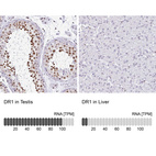 Anti-DR1 Antibody