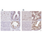 Anti-DR1 Antibody