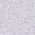 Anti-DR1 Antibody