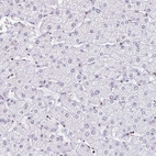 Immunohistochemical staining of human liver shows low expression as expected.