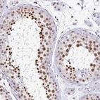 Immunohistochemical staining of human testis shows high expression.